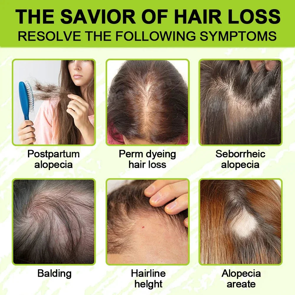 Anti Hair Loss